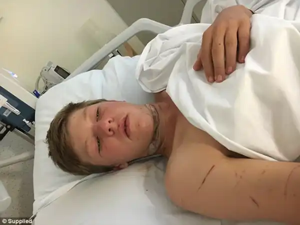 OMG! See What Earphones Did To This Teenage Boy After An Accident. Graphic Photos